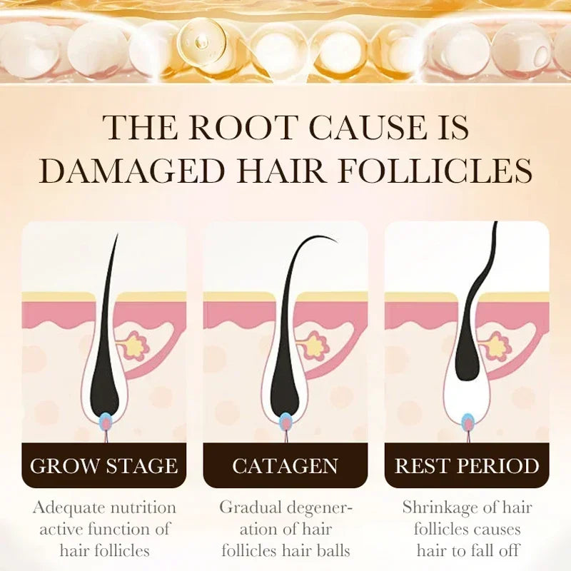 RootVigor