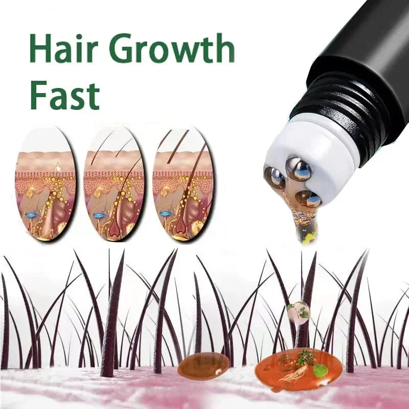 RootVigor